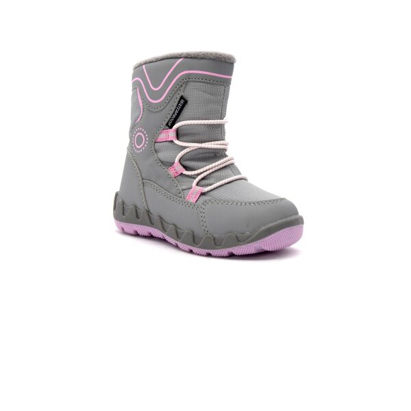 NEPREPUSTNE SKIBUCKE