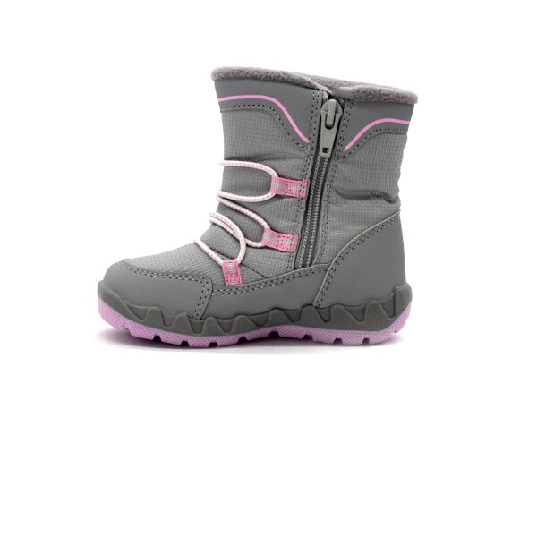 NEPREPUSTNE SKIBUCKE