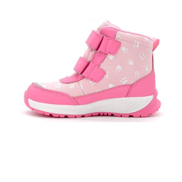 NEPREPUSTNE SKIBUCKE