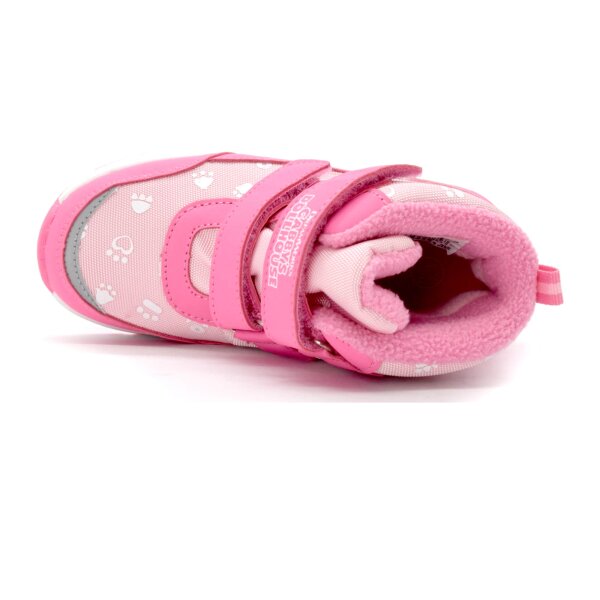 NEPREPUSTNE SKIBUCKE