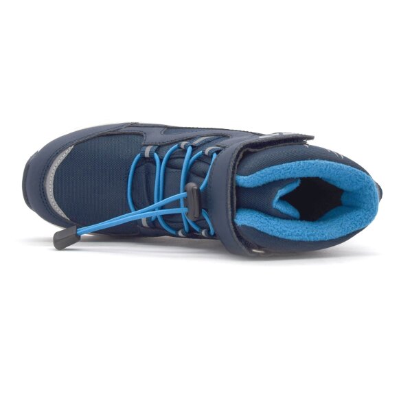 NEPREPUSTNE SKIBUCKE