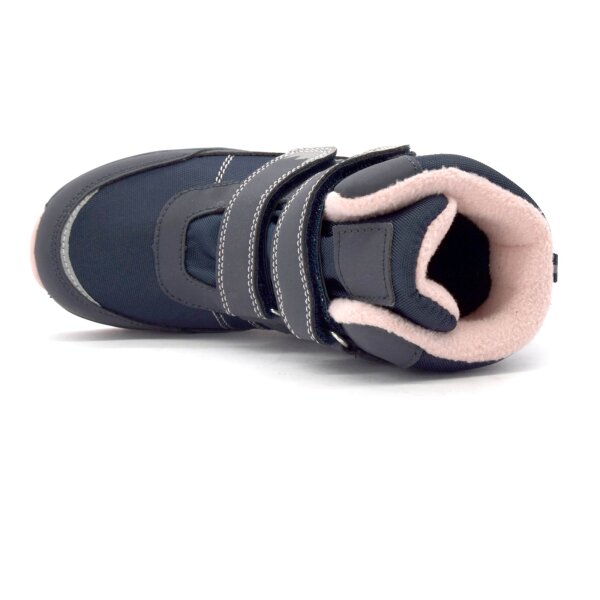 NEPREPUSTNE SKIBUCKE