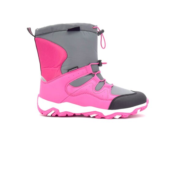 NEPREPUSTNE SKIBUCKE