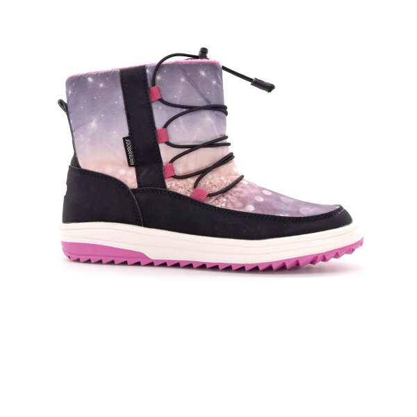 NEPREPUSTNE SKIBUCKE