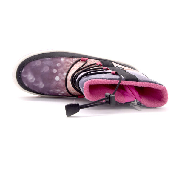 NEPREPUSTNE SKIBUCKE