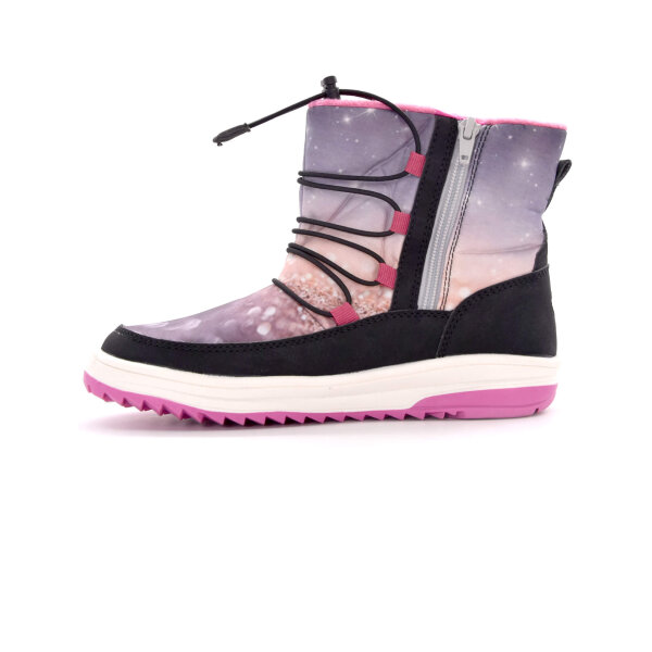 NEPREPUSTNE SKIBUCKE