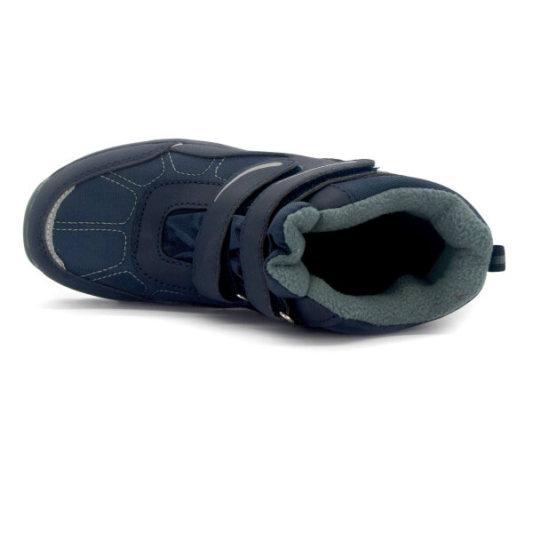 NEPREPUSTNE SKIBUCKE