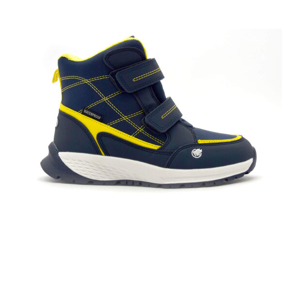 NEPREPUSTNE SKIBUCKE