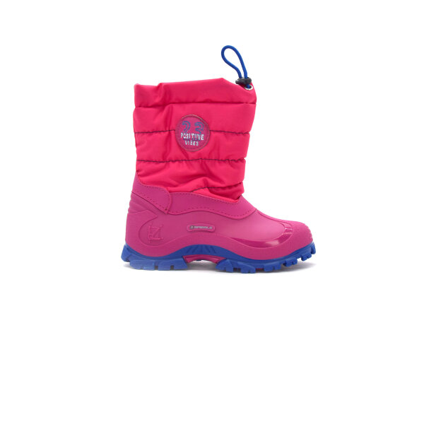 NEPREPUSTNE SKIBUCKE